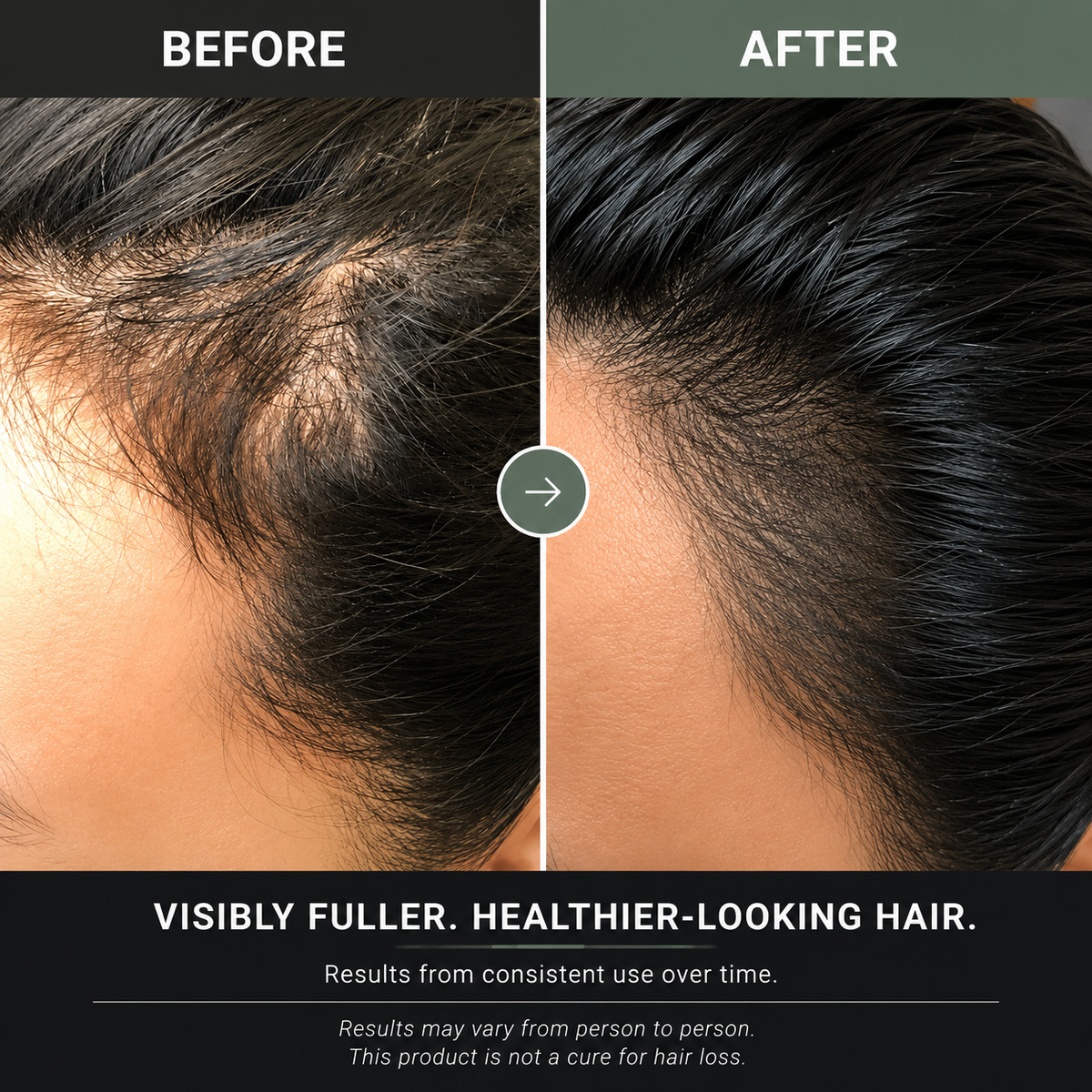 BloomSociety. Scalp Care Starter Kit
